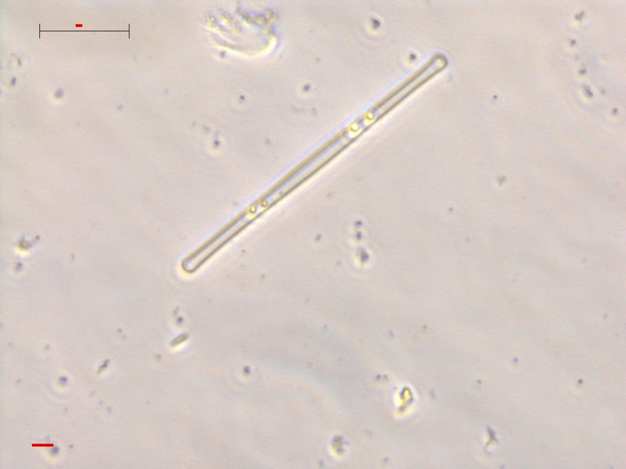 Asterionella notata?